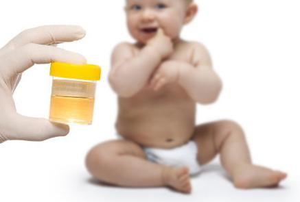 Cosa diranno le analisi delle urine (decodifica) nei bambini?
