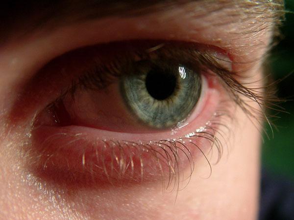 Perché gli occhi sono rossi e come eliminare il disagio?