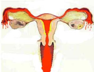Sanguinamento una settimana dopo le mestruazioni